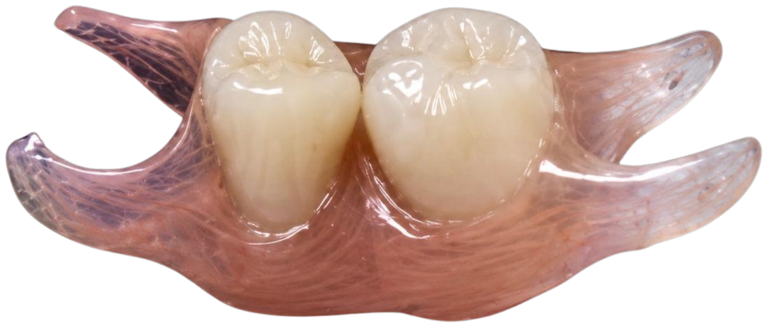Prótese dentária flexível de dois dentes, em material macio translúcido